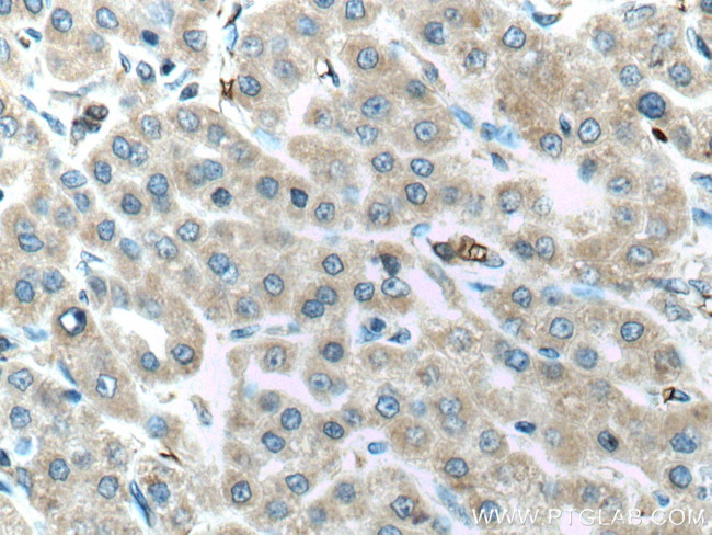 ALR Antibody in Immunohistochemistry (Paraffin) (IHC (P))