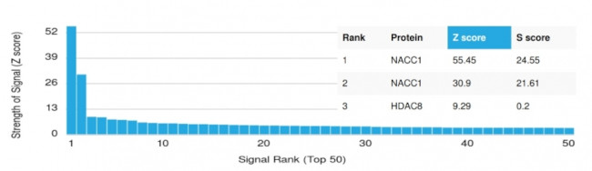 NACC1/Nac1/BTBD14B Antibody in Peptide array (ARRAY)