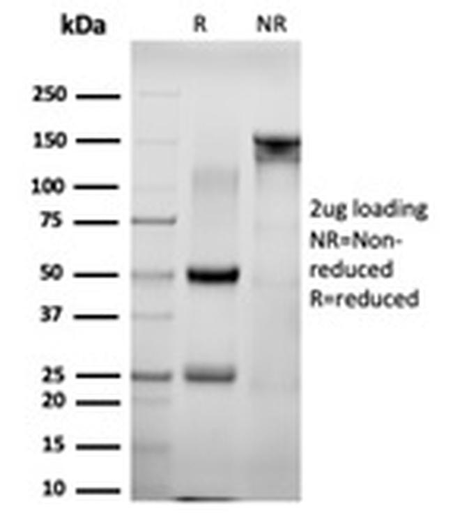 NACC1/Nac1/BTBD14B Antibody in SDS-PAGE (SDS-PAGE)