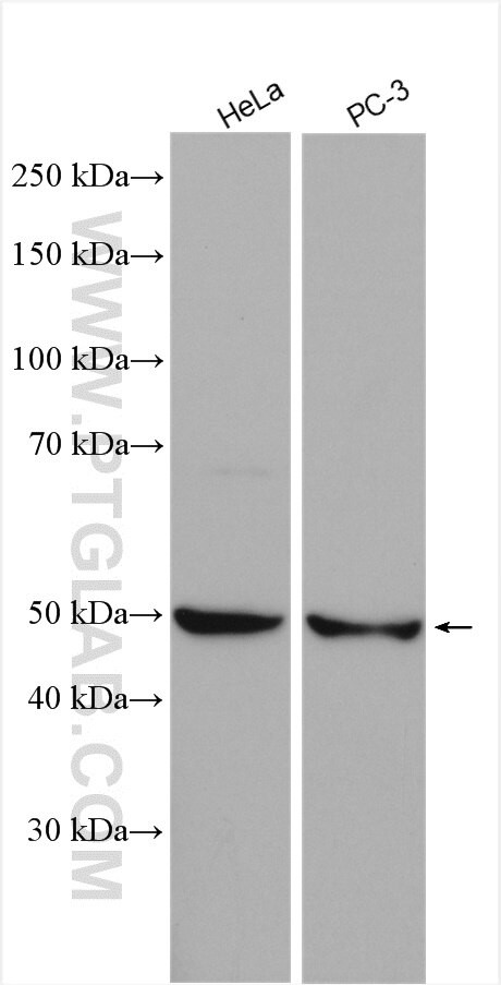 EIF2B3 Antibody in Western Blot (WB)