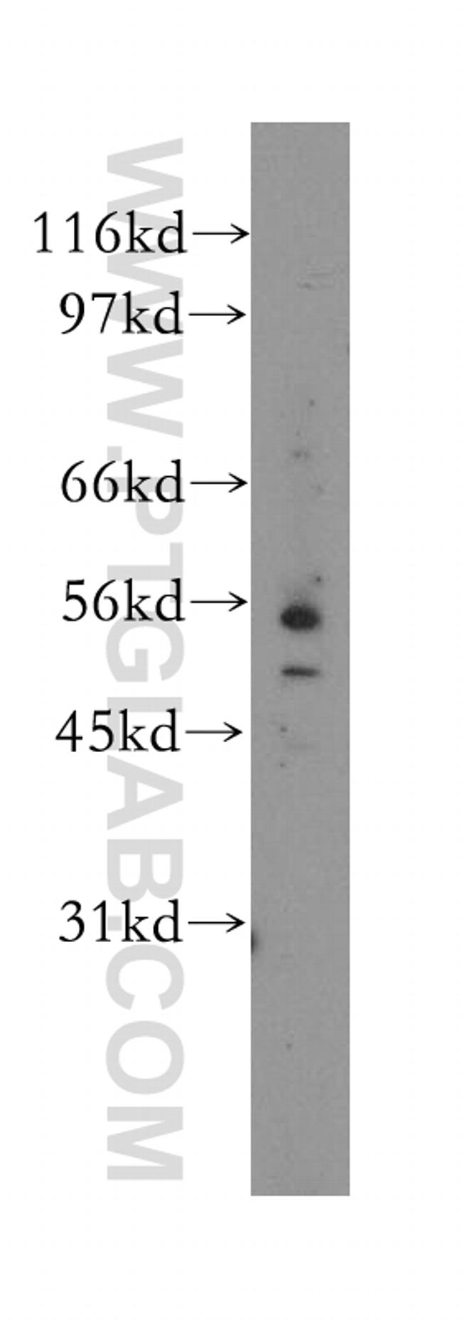 EIF2B3 Antibody in Western Blot (WB)