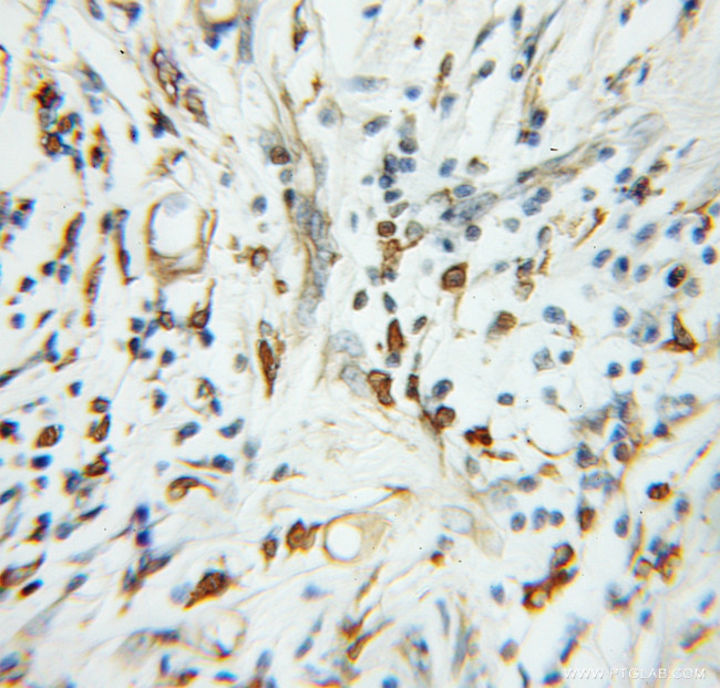 TADA2L Antibody in Immunohistochemistry (Paraffin) (IHC (P))