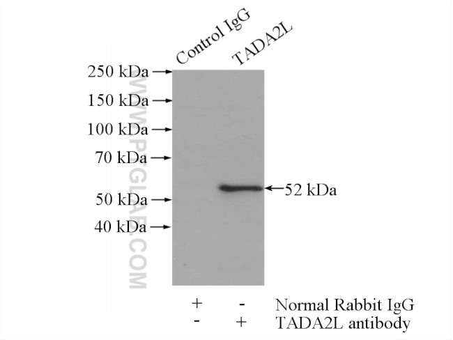 TADA2L Antibody in Immunoprecipitation (IP)