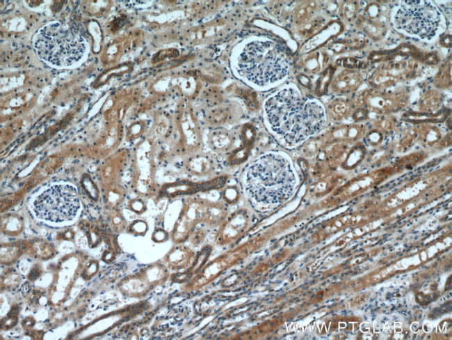 HARS2 Antibody in Immunohistochemistry (Paraffin) (IHC (P))