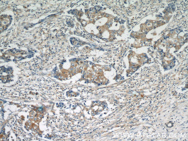 HARS2 Antibody in Immunohistochemistry (Paraffin) (IHC (P))