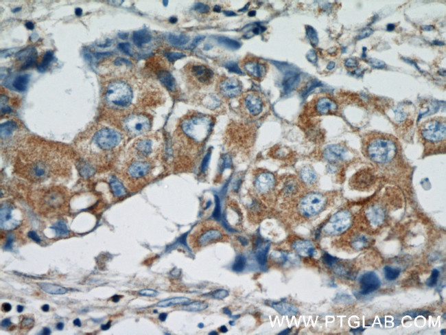 HARS2 Antibody in Immunohistochemistry (Paraffin) (IHC (P))