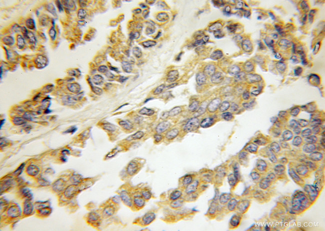 HARS2 Antibody in Immunohistochemistry (Paraffin) (IHC (P))