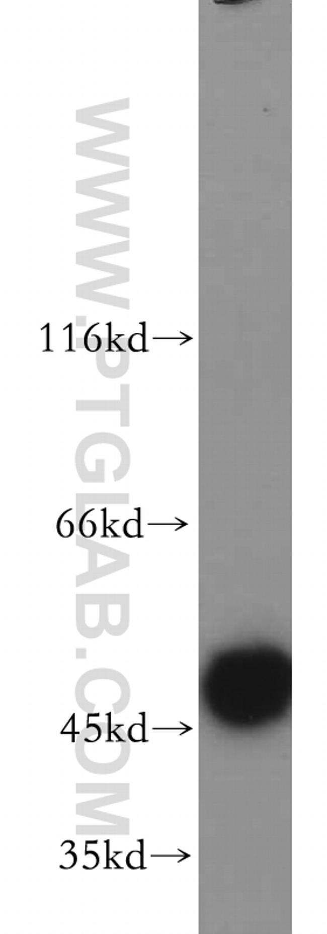 HARS2 Antibody in Western Blot (WB)