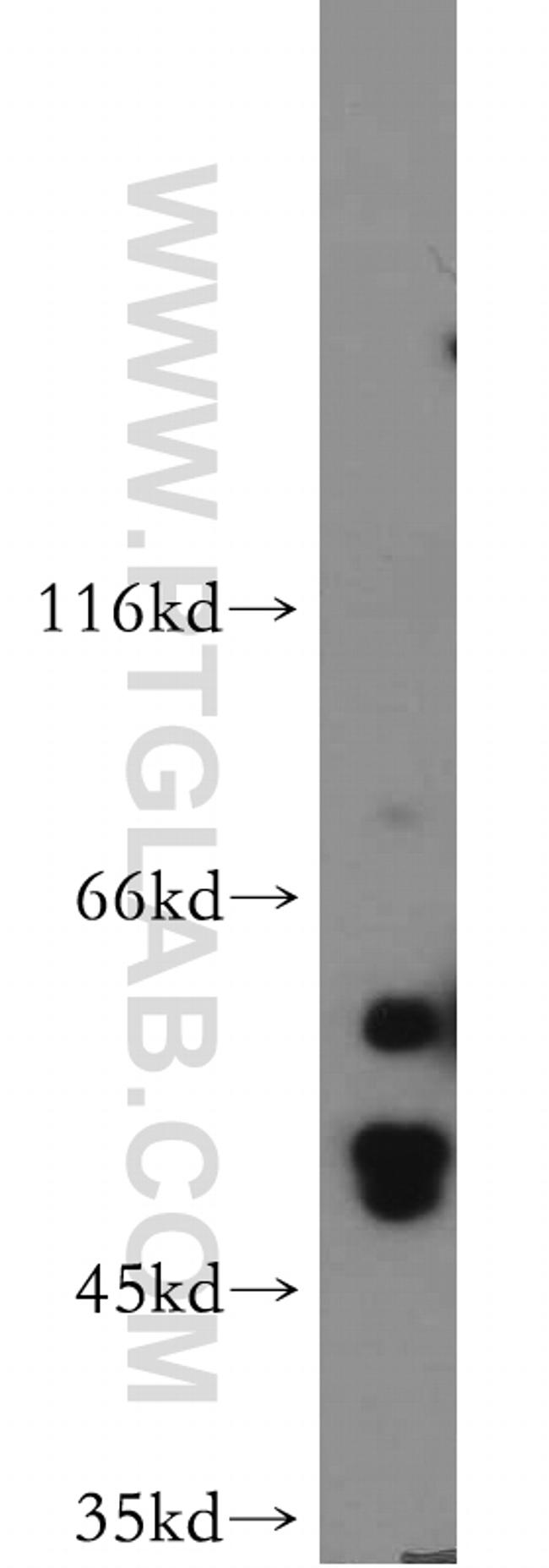 HARS2 Antibody in Western Blot (WB)