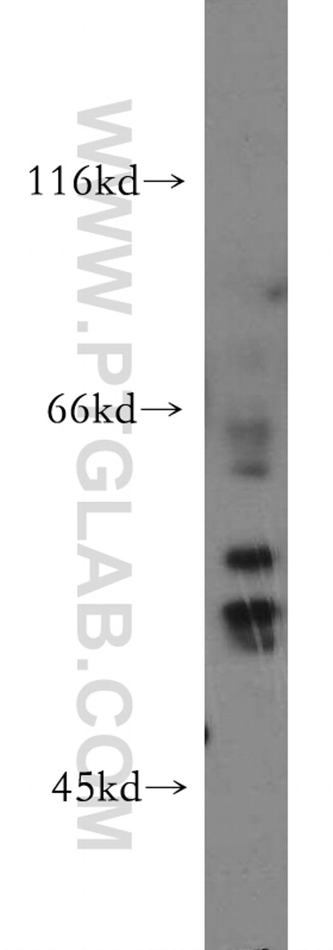 HARS2 Antibody in Western Blot (WB)