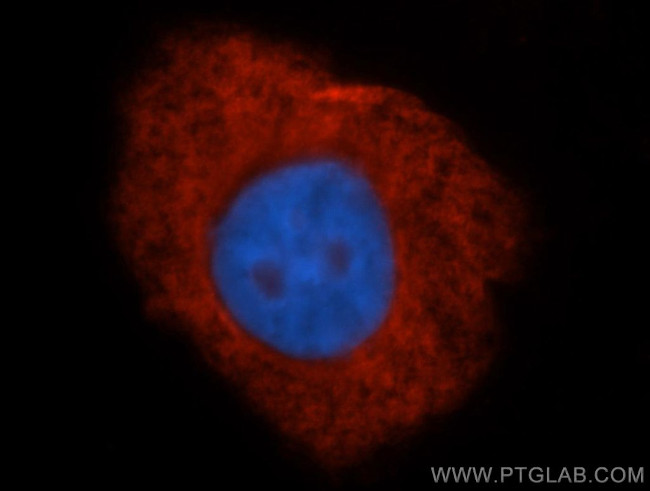 ribosomal protein L4 Antibody in Immunocytochemistry (ICC/IF)