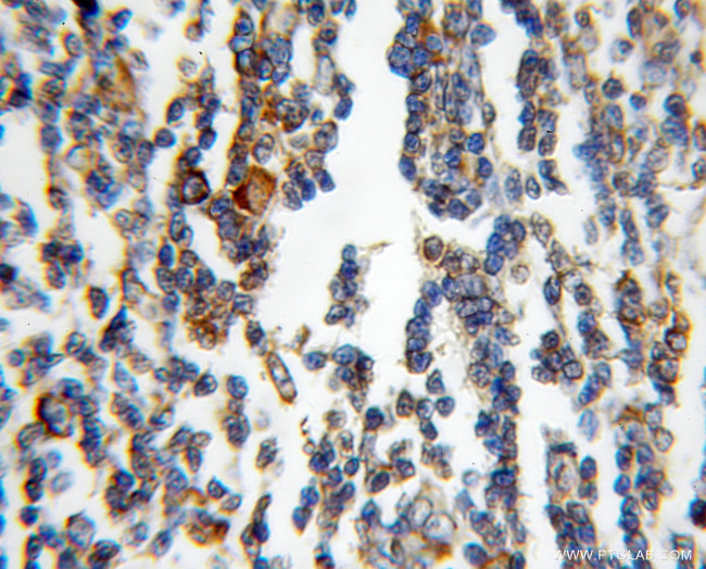 ribosomal protein L4 Antibody in Immunohistochemistry (Paraffin) (IHC (P))