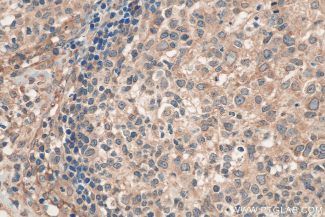 ribosomal protein L4 Antibody in Immunohistochemistry (Paraffin) (IHC (P))