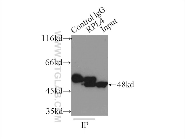 ribosomal protein L4 Antibody in Immunoprecipitation (IP)