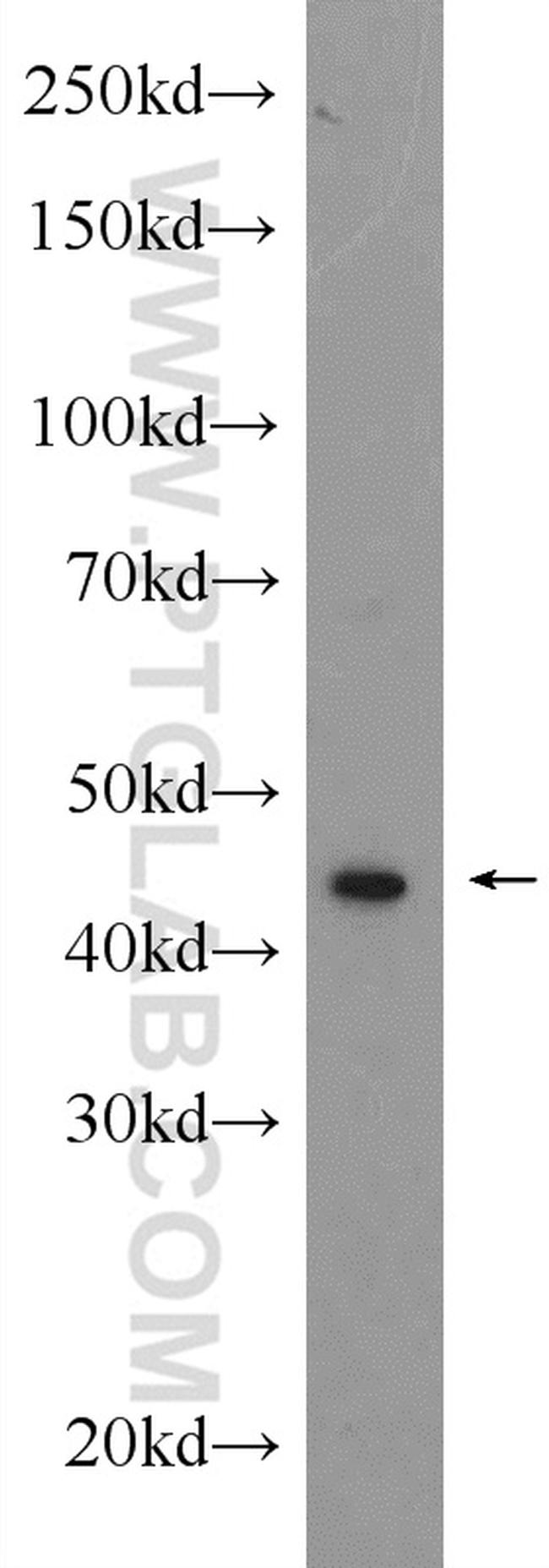 ribosomal protein L4 Antibody in Western Blot (WB)