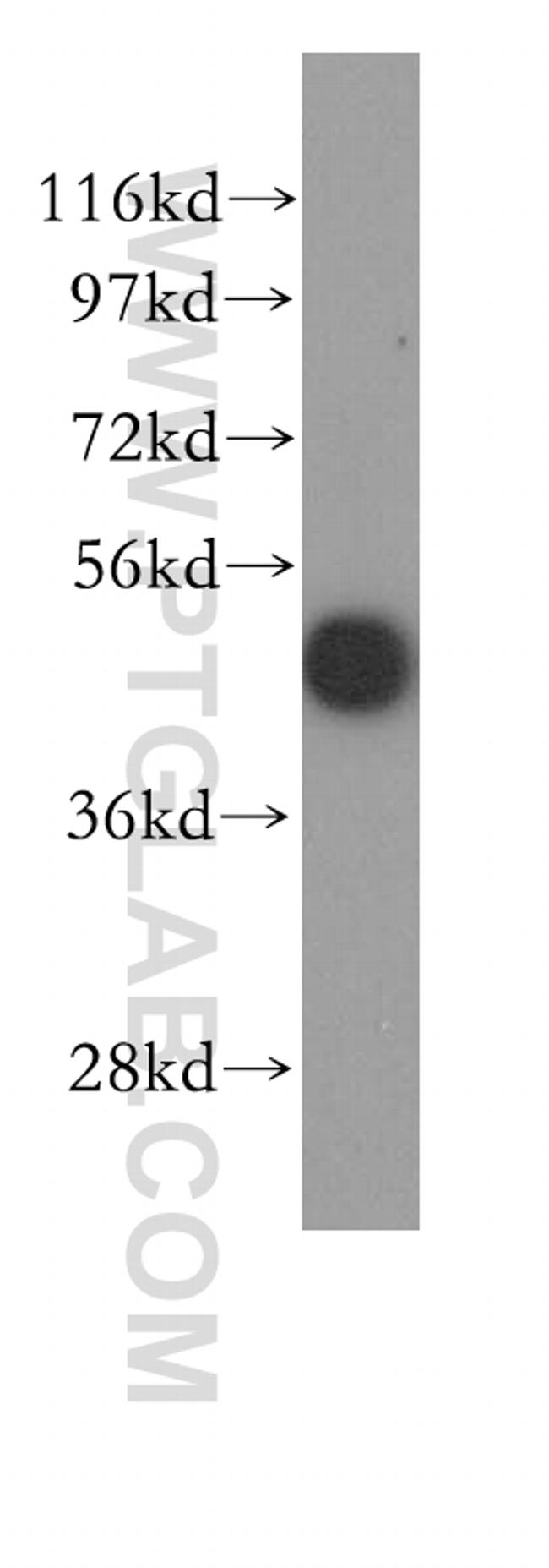 ribosomal protein L4 Antibody in Western Blot (WB)