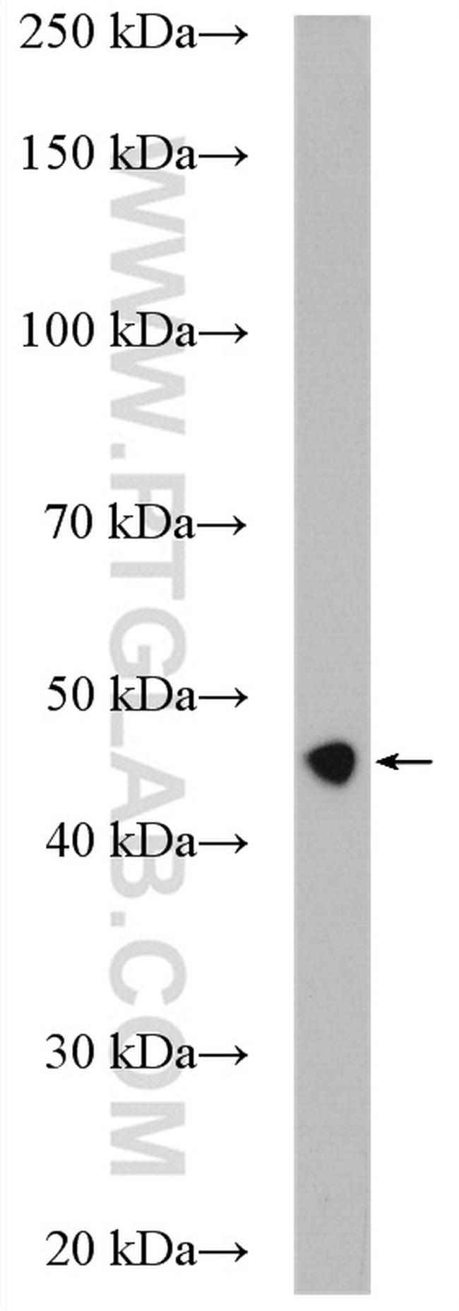 ribosomal protein L4 Antibody in Western Blot (WB)