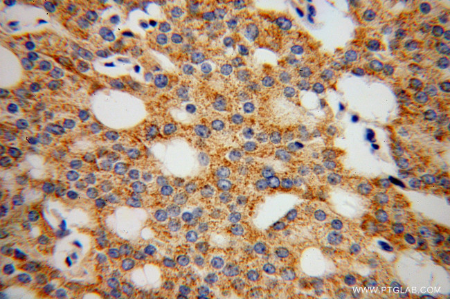 Rab18 Antibody in Immunohistochemistry (Paraffin) (IHC (P))