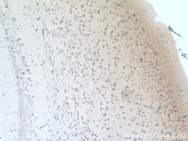 Rab18 Antibody in Immunohistochemistry (Paraffin) (IHC (P))