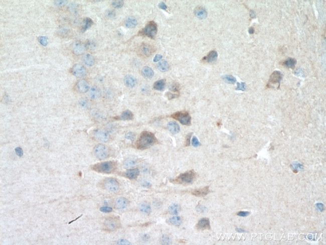 Rab18 Antibody in Immunohistochemistry (Paraffin) (IHC (P))