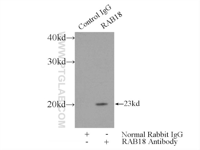 Rab18 Antibody in Immunoprecipitation (IP)