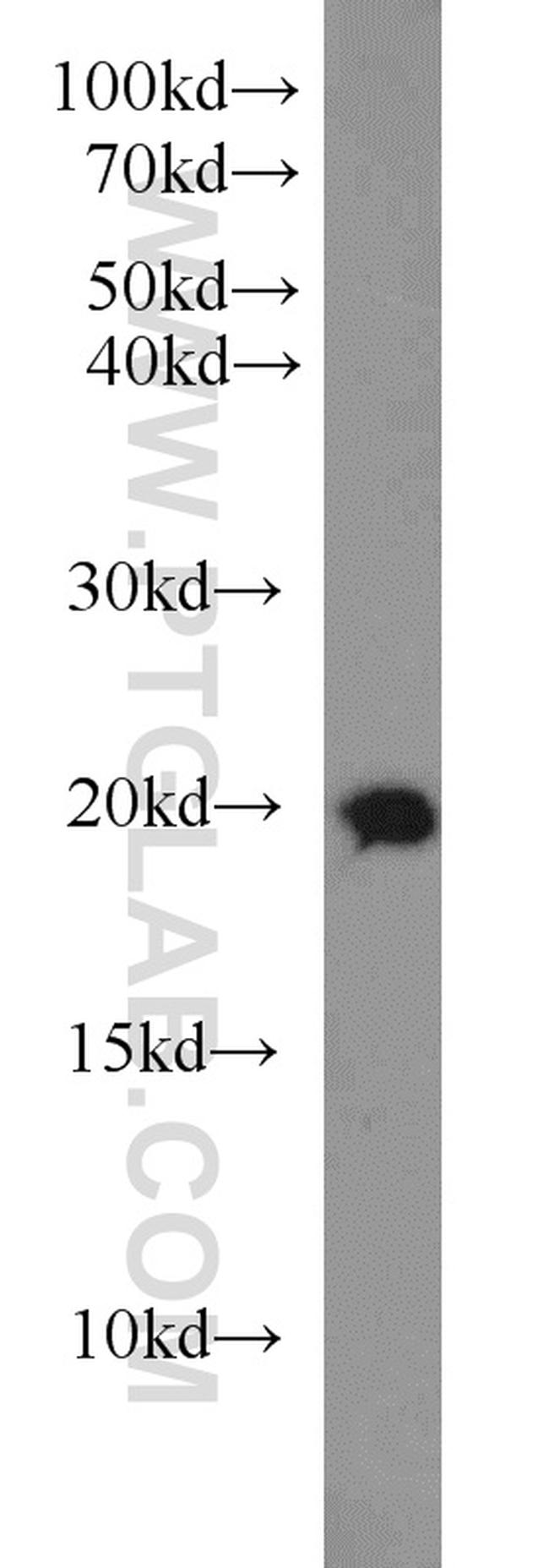 Rab18 Antibody in Western Blot (WB)