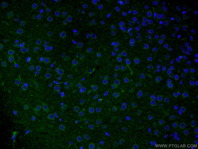 Rab18 Antibody in Immunohistochemistry (PFA fixed) (IHC (PFA))