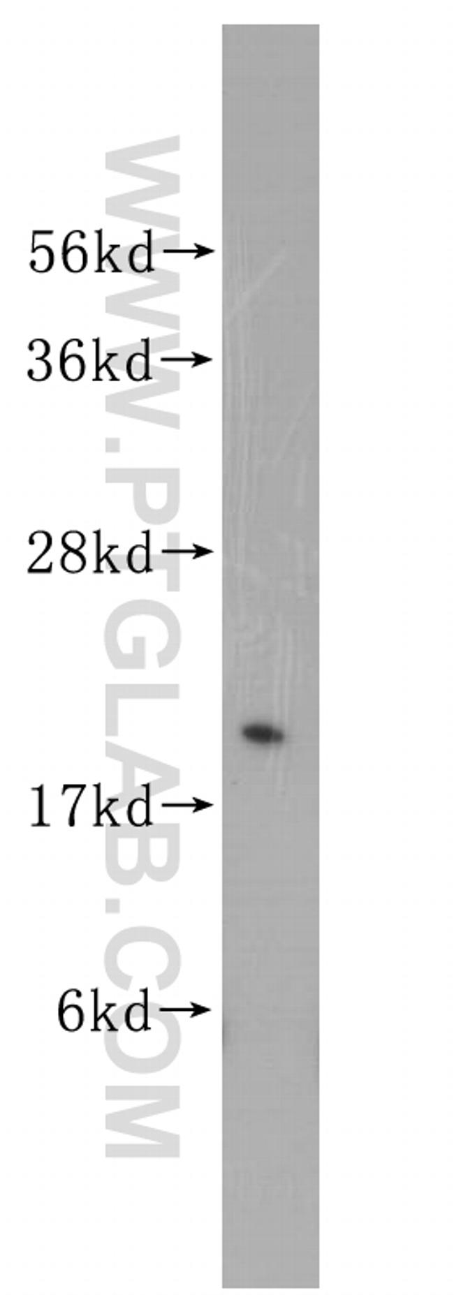 Rab18 Antibody in Western Blot (WB)