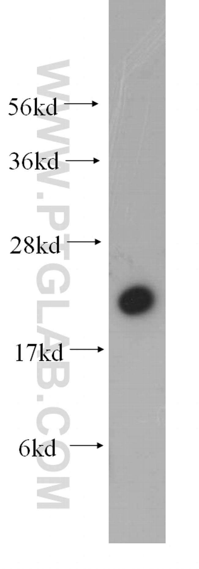 Rab18 Antibody in Western Blot (WB)