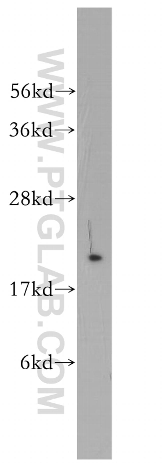 Rab18 Antibody in Western Blot (WB)