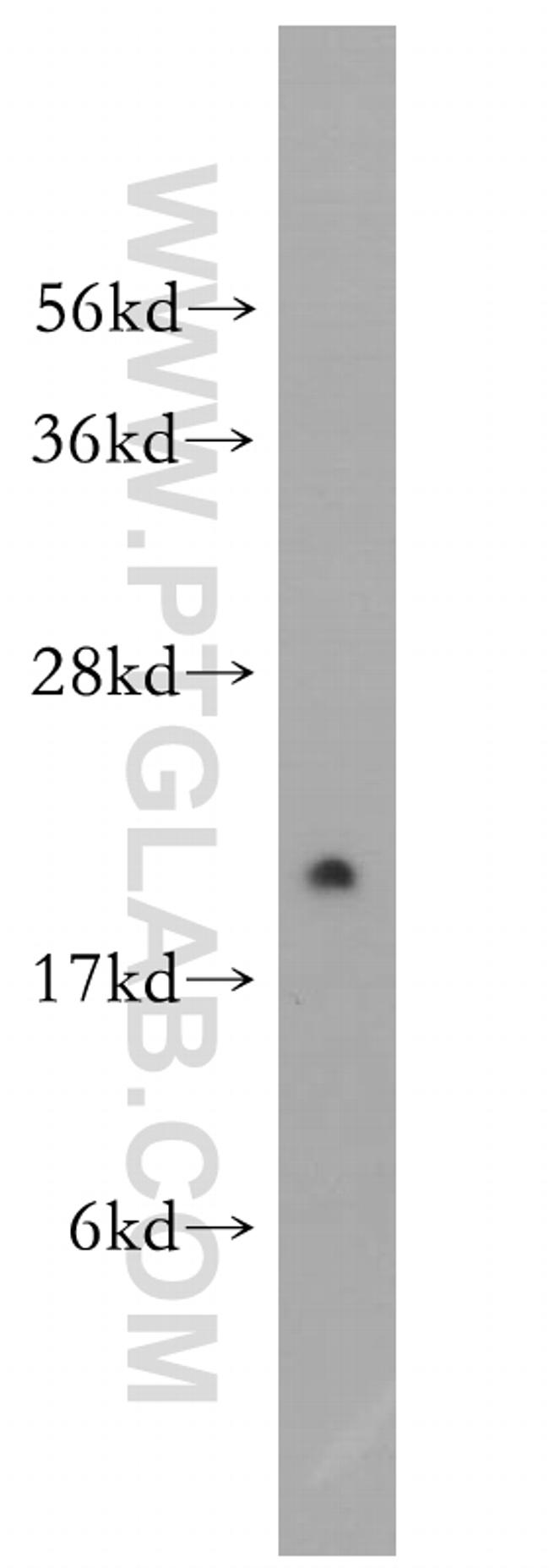 Rab18 Antibody in Western Blot (WB)