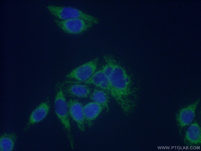 ECHS1 Antibody in Immunocytochemistry (ICC/IF)