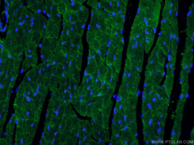 Beclin 1 Antibody in Immunohistochemistry (PFA fixed) (IHC (PFA))