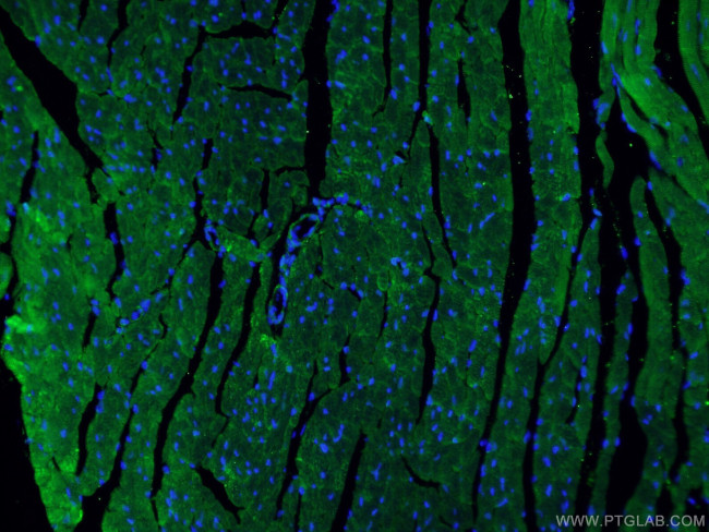 Beclin 1 Antibody in Immunohistochemistry (PFA fixed) (IHC (PFA))