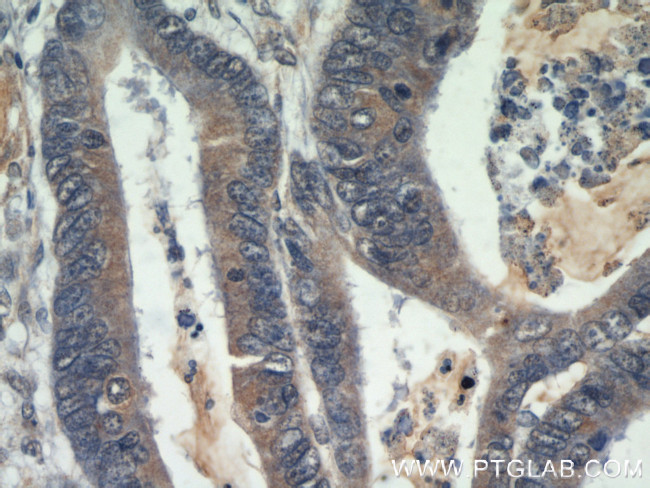 Beclin 1 Antibody in Immunohistochemistry (Paraffin) (IHC (P))