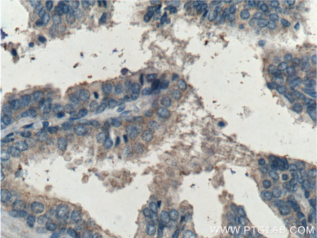 Beclin 1 Antibody in Immunohistochemistry (Paraffin) (IHC (P))