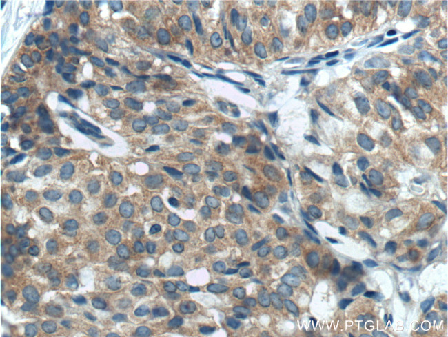 Beclin 1 Antibody in Immunohistochemistry (Paraffin) (IHC (P))