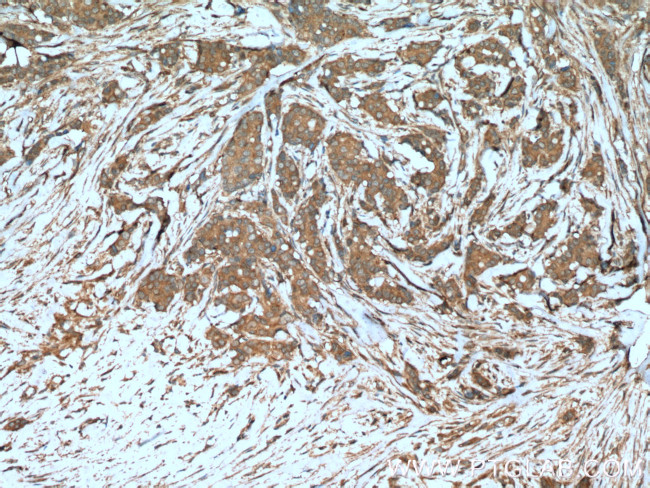 Beclin 1 Antibody in Immunohistochemistry (Paraffin) (IHC (P))