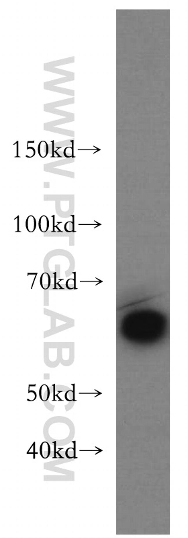 Beclin 1 Antibody in Western Blot (WB)