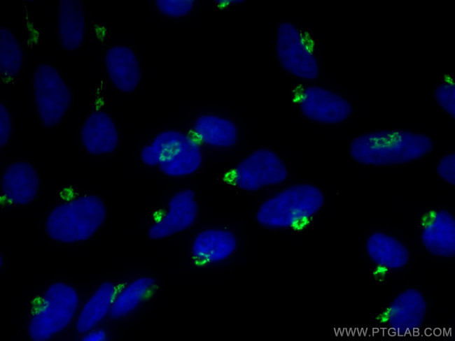 GOLGA2/GM130 Antibody in Immunocytochemistry (ICC/IF)