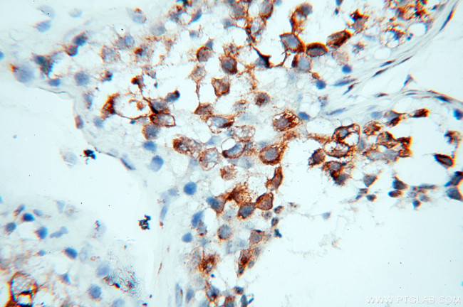 GOLGA2/GM130 Antibody in Immunohistochemistry (Paraffin) (IHC (P))