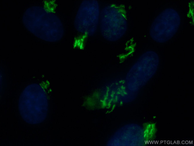 GOLGA2/GM130 Antibody in Immunocytochemistry (ICC/IF)