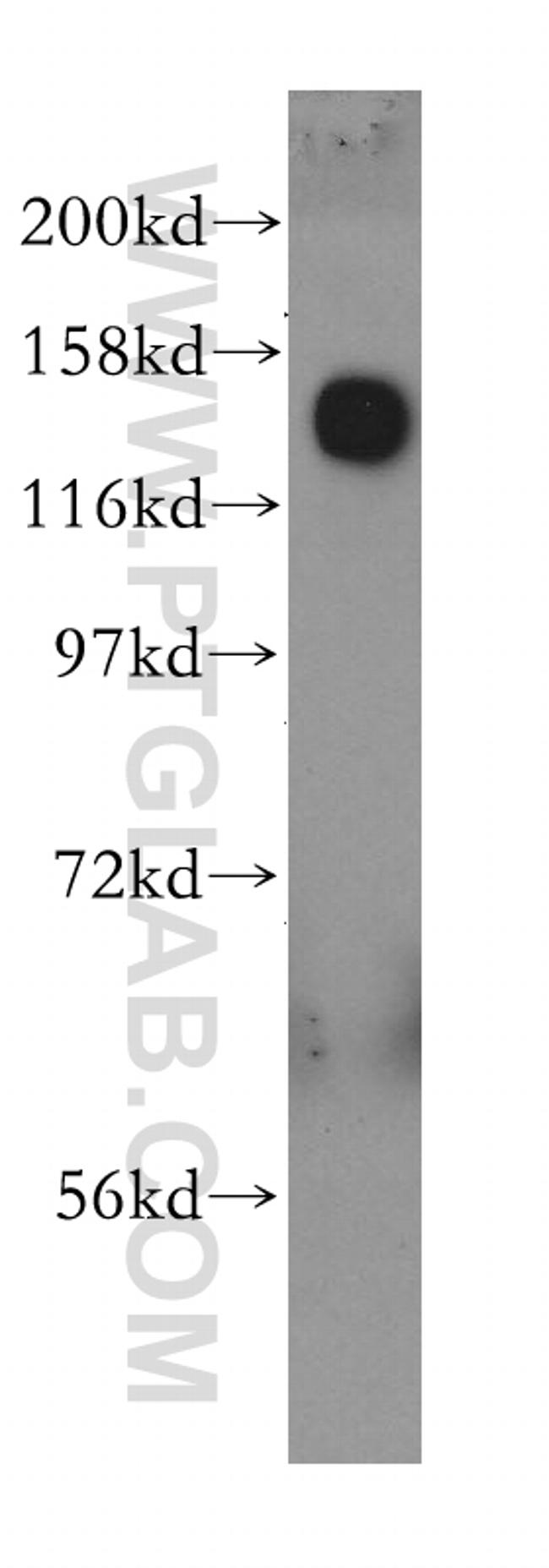 GOLGA2/GM130 Antibody in Western Blot (WB)