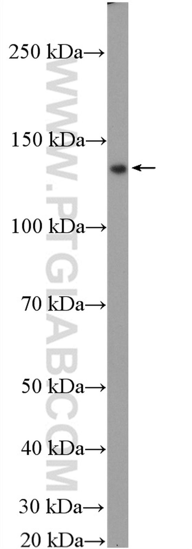 GOLGA2/GM130 Antibody in Western Blot (WB)