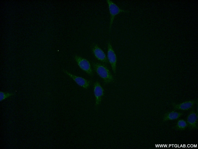 EIF5A Antibody in Immunocytochemistry (ICC/IF)