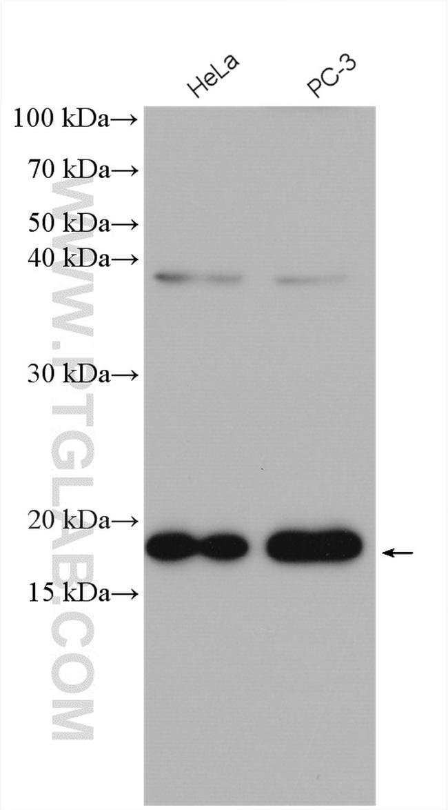 EIF5A Antibody in Western Blot (WB)