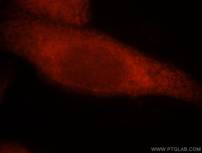 IRF3 Antibody in Immunocytochemistry (ICC/IF)