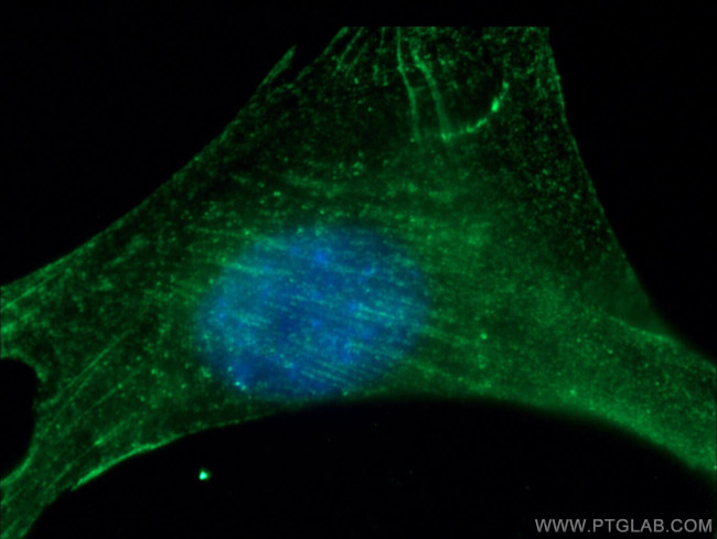 alpha Actinin Antibody in Immunocytochemistry (ICC/IF)