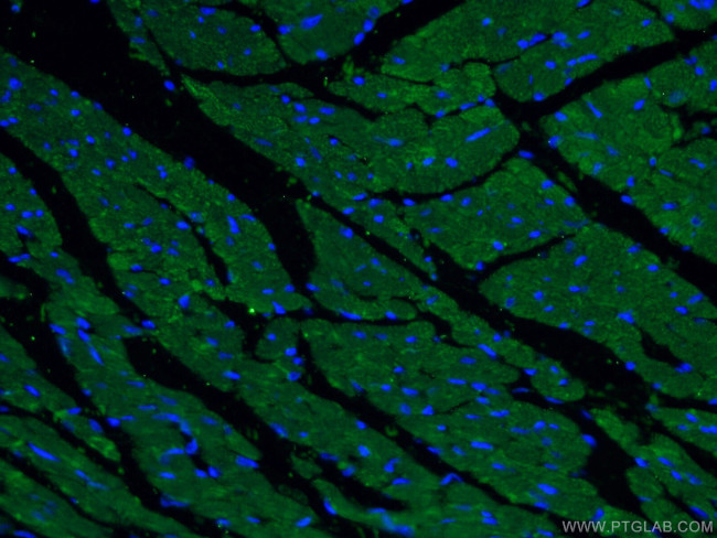 alpha Actinin Antibody in Immunohistochemistry (PFA fixed) (IHC (PFA))