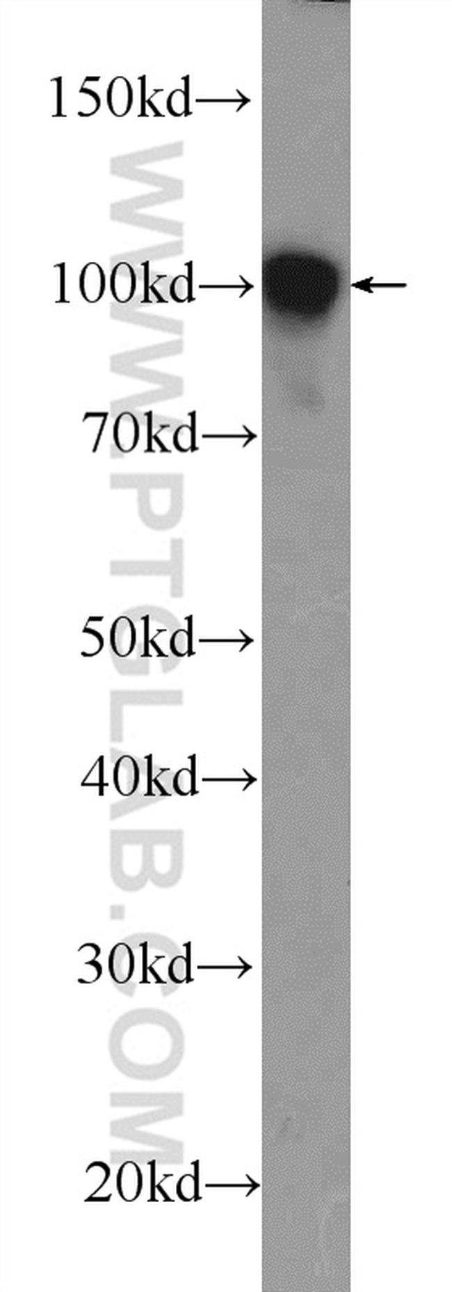 alpha Actinin Antibody in Western Blot (WB)